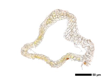cephaloziella massalongi 1 perianth basis quer