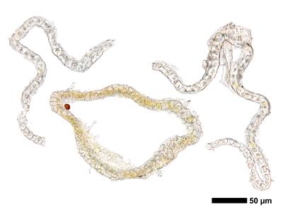 cephaloziella massalongi 1 perianth mitte quer