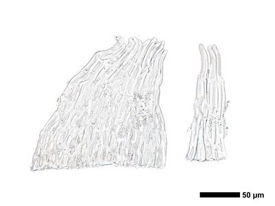 cephaloziella massalongi 1 perianthmuendung