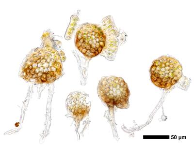 cephaloziella massalongi 1 stamm quer
