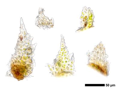 cephaloziella massalongi 1 unterblatt