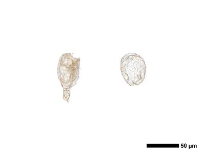 cephaloziella phyllacantha 1 antheridien