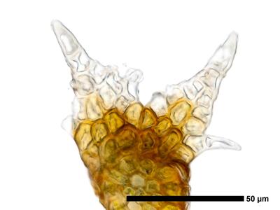 cephaloziella phyllacantha 1 flankenblatt zellen