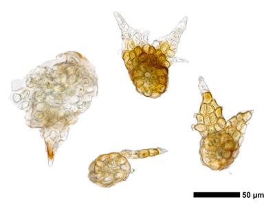 cephaloziella phyllacantha 1 stamm quer