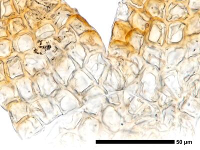 cephaloziella rubella 1 flankenblatt zellen