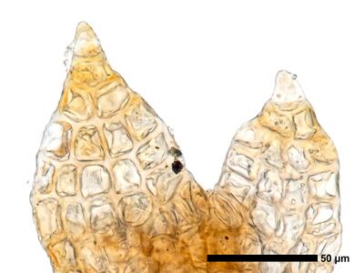cephaloziella rubella 1 flankenblatt zellen blattspitze