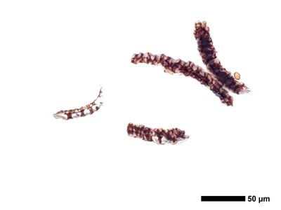 cephaloziella rubella 1 kapsel quer