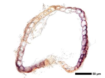 cephaloziella rubella 1 perianth mitte quer