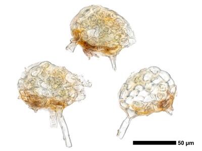 cephaloziella spinigera f striatula 1 stamm quer