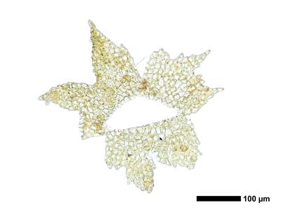 cephaloziella spinigera f striatula 2 female bract ring