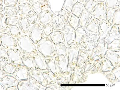 cephaloziella spinigera f striatula 2 flankenblatt zellen