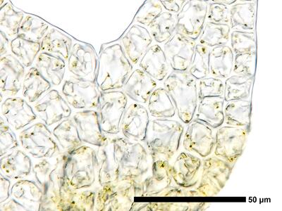 cephaloziella spinigera f striatula 2 flankenblatt zellen blattrand