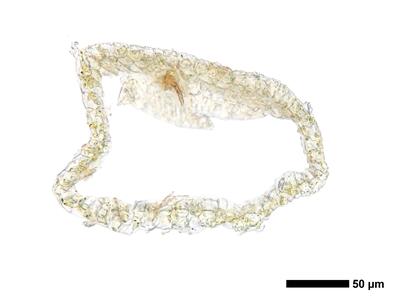 cephaloziella spinigera f striatula 2 perianth basis quer