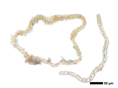 cephaloziella spinigera f striatula 2 perianth mitte quer