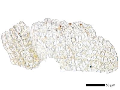 cephaloziella spinigera f striatula 2 perianthmuendung