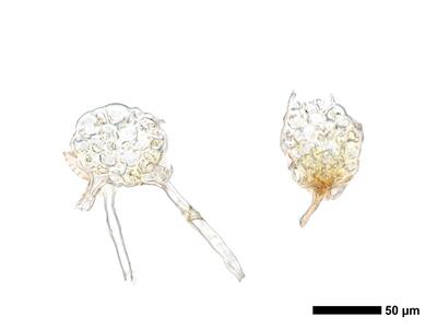 cephaloziella spinigera f striatula 2 stamm quer