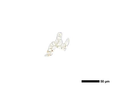 cephaloziella spinigera f striatula 2 unterblatt