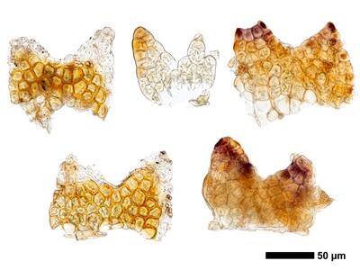cephaloziella stellulifera 1 flankenblatt