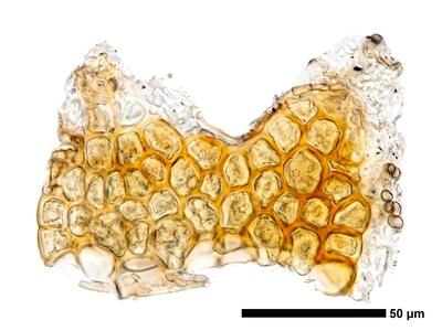 cephaloziella stellulifera 1 flankenblatt zellen