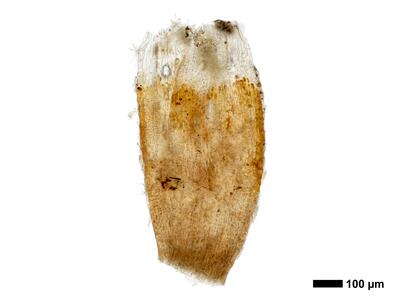 cephaloziella stellulifera 1 perianth