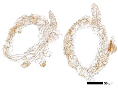 cephaloziella stellulifera 1 perianth archegonien
