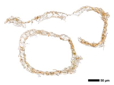 cephaloziella stellulifera 1 perianth mitte quer