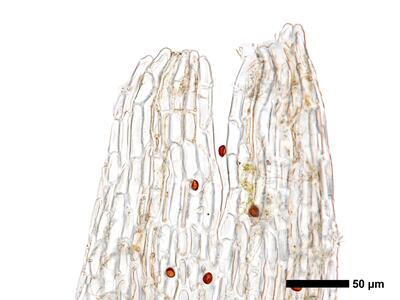 cephaloziella stellulifera 1 perianthmuendung