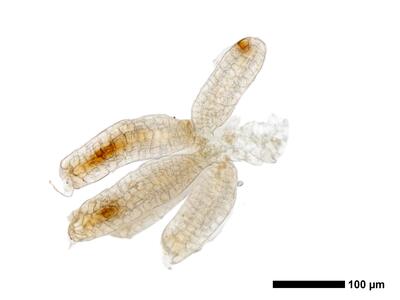 obtusifolium obtusum archegonien