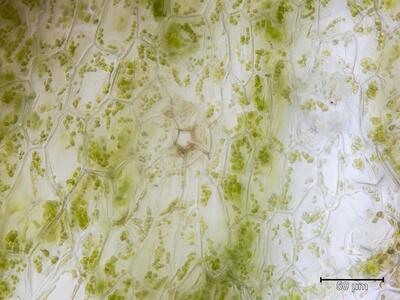 athalamia hyalina atemporen aufsicht 1