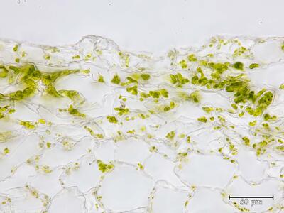 athalamia hyalina atemporen quer