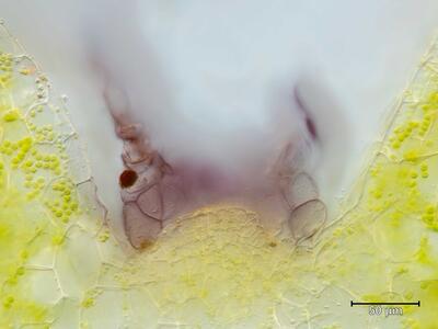 athalamia hyalina frisch archegonienstand quer