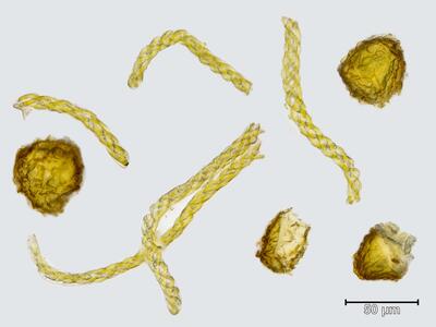 athalamia hyalina sporen