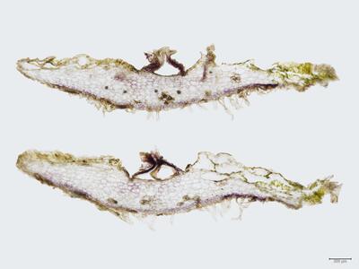 peltolepis quadrata antheridienstand quer
