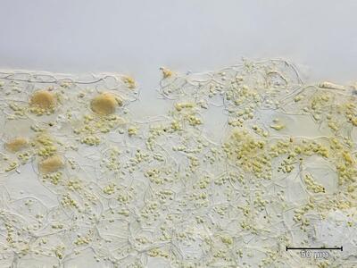 peltolepis quadrata atemporen quer