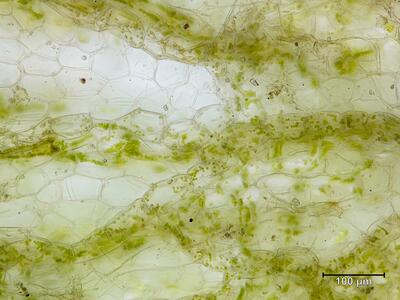 sauteria alpina thallus aufsicht