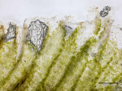 sauteria alpina thallusrand aufsicht