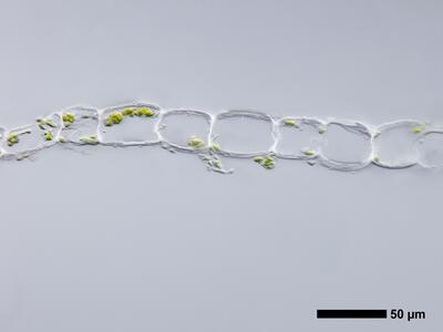endogemma caespiticia 1 flankenblatt quer detail