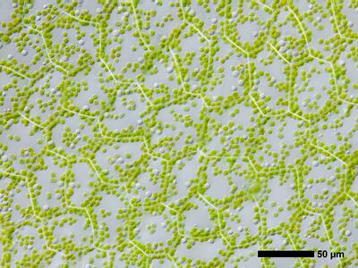fossombronia foveolata frisch flankenblatt blattmitte1