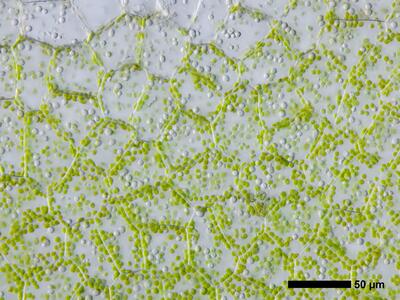 fossombronia foveolata frisch flankenblatt blattmitte2