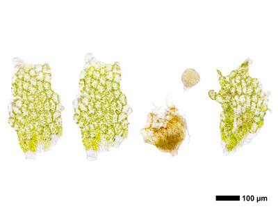 fossombronia foveolata frisch hochblatt antheridien