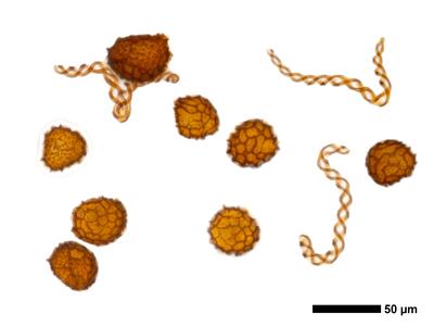 fossombronia foveolata frisch sporen elateren