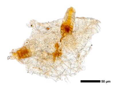 gymnomitrion adustum 1 archegonien
