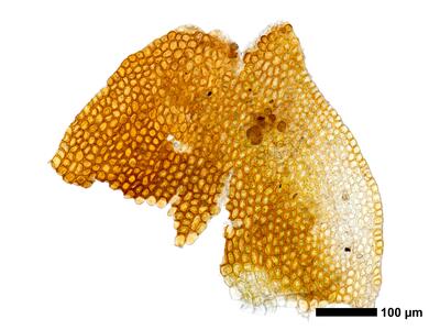 gymnomitrion adustum 1 female bract
