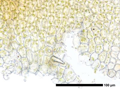 gymnomitrion adustum 1 flankenblatt blattbasis