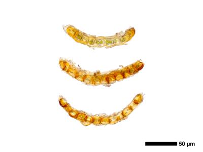 gymnomitrion adustum 1 flankenblatt quer
