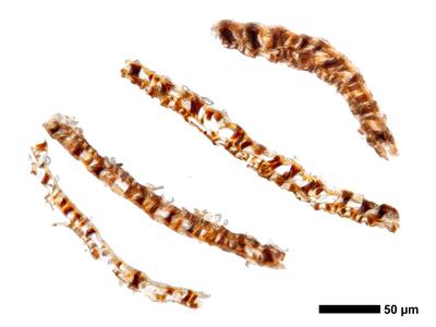 gymnomitrion adustum 1 kapsel quer