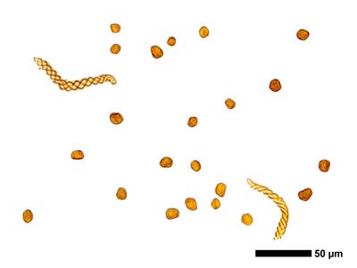 gymnomitrion adustum 1 sporen elateren