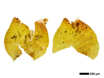 gymnomitrion alpinum 1 female bract