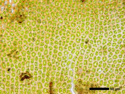 gymnomitrion alpinum 1 flankenblatt blattmitte