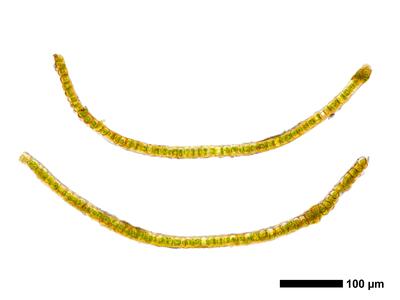 gymnomitrion alpinum 1 flankenblatt quer
